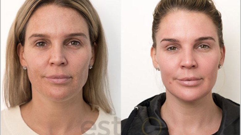 Dubai Beauty Guide: Secrets to Healthy Skin in the UAE